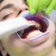 Canada dental program